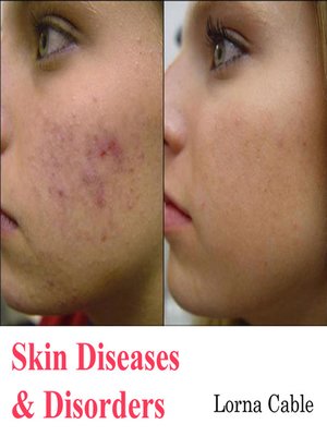 cover image of Skin Diseases and Disorders